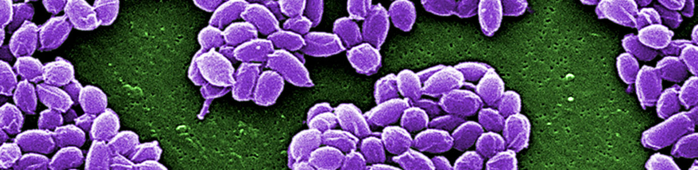 anthrax bacteria microscope image stained purple