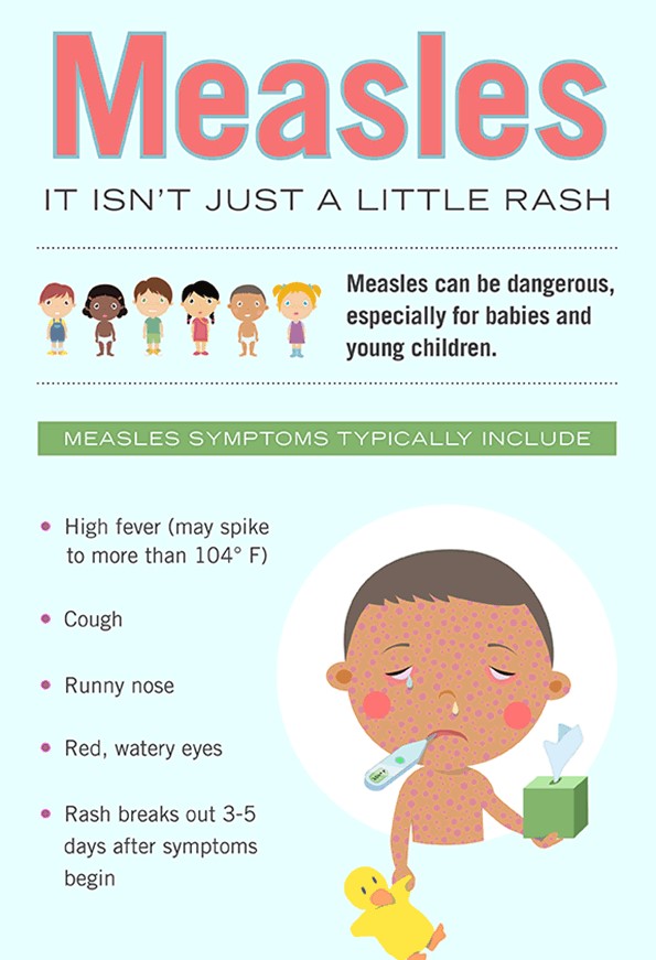 Measles Disease Surveillance Epidemiology Program Mecdc Dhhs Maine