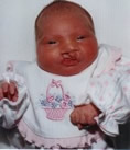 Child with cleft palate