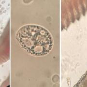 Large numbers of Chilodonella on largemouth bass gills